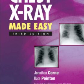 Chest X-Ray Made Easy (کیفیت چاپ سوپر پیکسل)