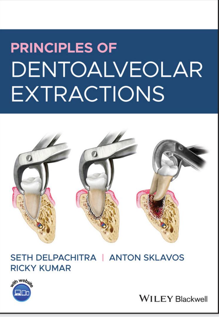 Principles of Dentoalveolar Extractions 2021 (کیفیت چاپ سوپرپیکسل)