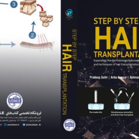 Step by Step Hair Transplantation  (کیفیت چاپ سوپرپیکسل)