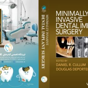 Minimally Invasive Dental Implant Surgery (کیفیت چاپ سوپرپیکسل)